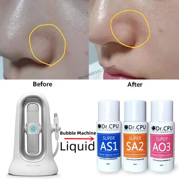 30ml Concentrat Aqua Peeling Soluție AS1 SA2 AO3 Ser Pentru Aqua Peeling Mașină SPA Facial de Curatare Profunda Dispozitiv de Frumusete